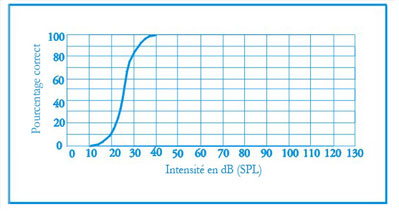 Audiogramme pour pathologie de l'oreille