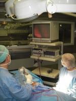 Vidéochirurgie des sinus